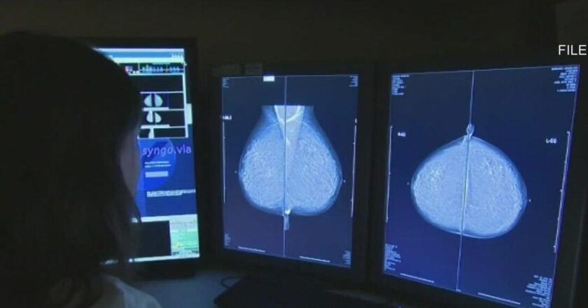 New Hispanic Breast Cancer Clinic at Northwestern aims to improve access to care